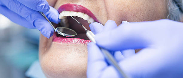 Best Emergency Treatment for Toothache in Larkfield Wikiup, CA