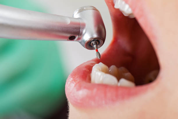 Best Emergency Dental Care for Trauma or Injury in Larkfield Wikiup, CA